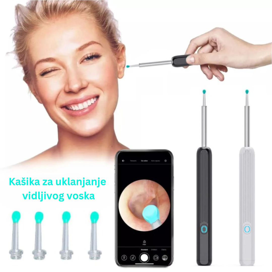 Pametni Vizuelni Čistač Ušiju sa Kamerom