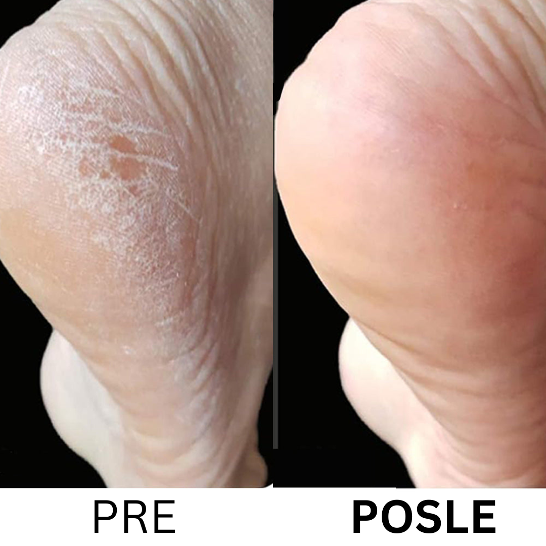 Profesionalna Električna Turpija za Negu Stopala