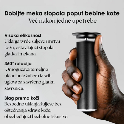 Profesionalna Električna Turpija za Negu Stopala