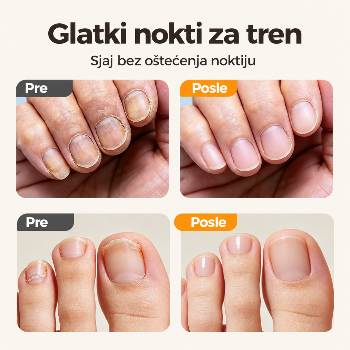 SmoothNail™ – 2 u 1 Fina Grickalica Za Nokte