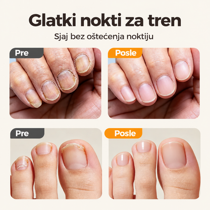 SmoothNail™ – 2 u 1 Fina Grickalica Za Nokte