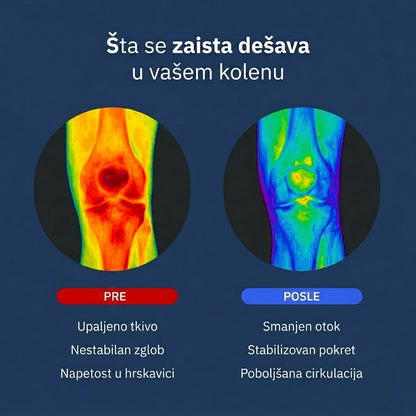 KneeGuard™ – Podesivi Steznik